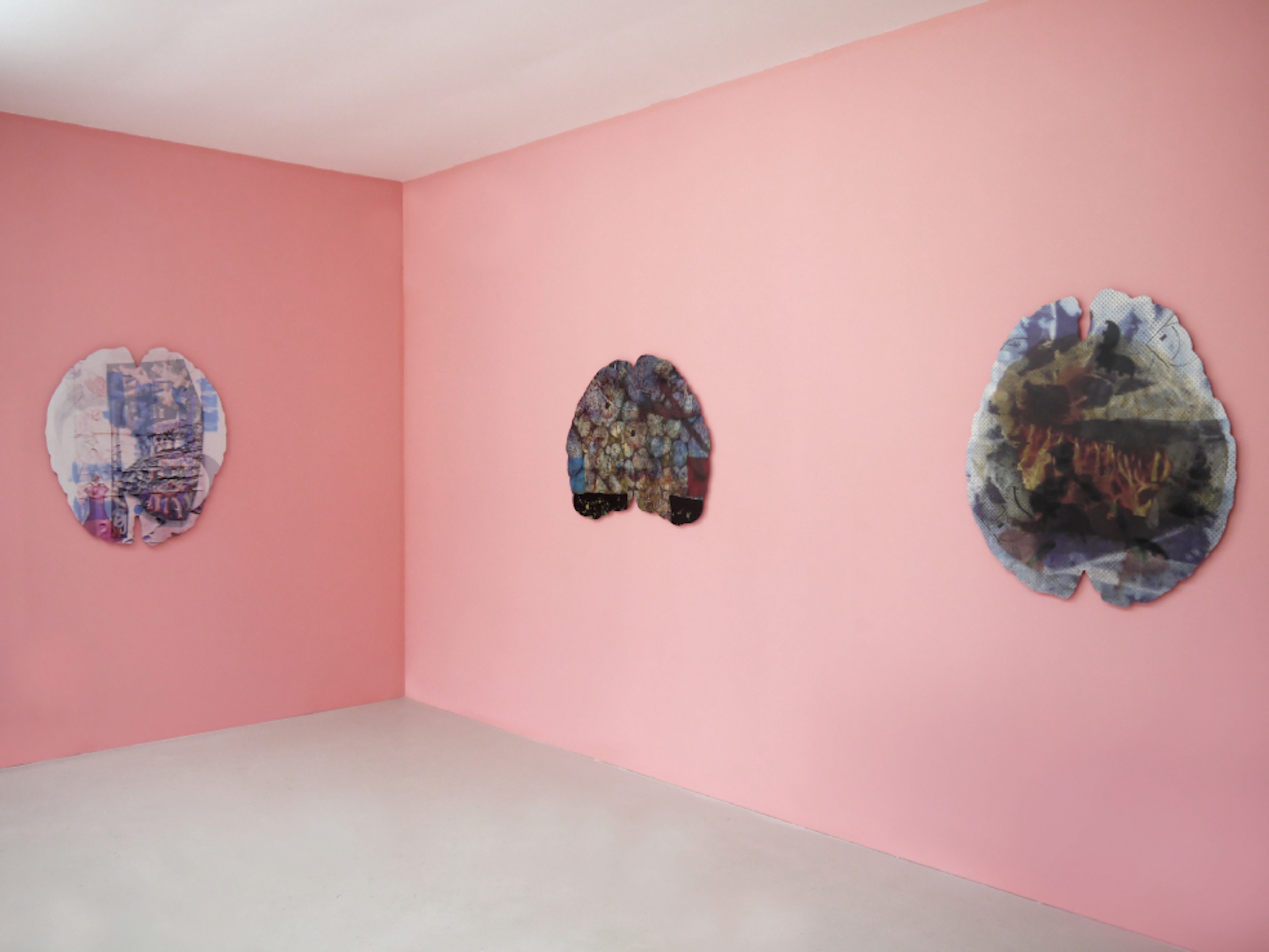 Mental Matters - Les Bains-Douches, Alençon